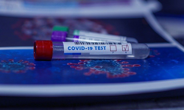 Мазки, антитіла, тести: де у Києві перевіритися на коронавірус